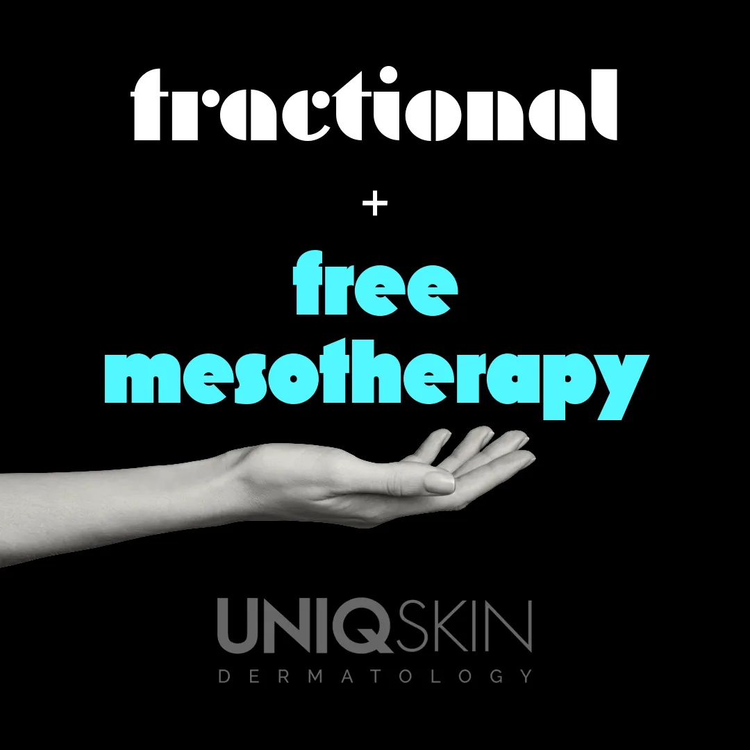Fractional Laser + Δωρεάν Μεσοθεραπεία προσφορά